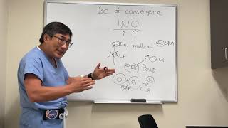 Testing convergence to localise internuclear ophthalmoplegia INO lesion [upl. by Seiden]