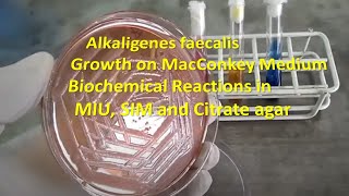 Alkaligenes faecalis Colony Morphology on Macconkey agar and Biochemical Reactions Demonstration [upl. by Esinert]