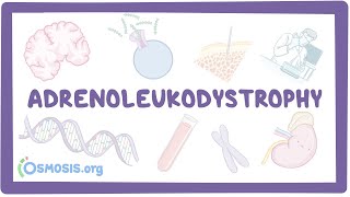 Adrenoleukodystrophy  causes symptoms diagnosis treatment pathology [upl. by Llenrrad]