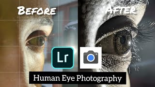 EYE Photography Without Macro Lens  Lightroom Mobile Editing  Tutorial  Google Camera GCAM [upl. by Meredithe]