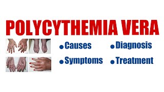 Polycythemia Vera  overview causes symptoms diagnosis treatment prognosis all explained [upl. by Emeric567]