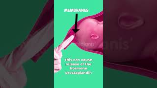 मेम्ब्रेन स्वीप Membrane Sweep क्या है 🤔 Is it safe⁉️ pregnancy labor birth [upl. by Elisha]