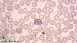 What Does a Low White Blood Cell Count Mean [upl. by Willis]