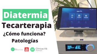 ¿Qué es la tecarterapia Patologías indicadas ✅ Diatermia Madrid Clínicas H3 [upl. by Aleras]