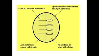 Lecithinase or Naglers Test [upl. by Cuyler974]