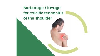 Barbotage lavage procedure for calcific tendon [upl. by Cyrie]