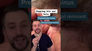 Derm explains preauricular sinus [upl. by Lillie]