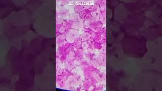 Squamous epithelial cells microscope slide🔬shortvideo youtube [upl. by Asi]