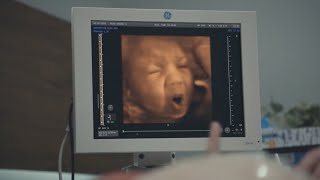 Is your baby gonna love or hate Marmite  Marmite Baby Scan Advert [upl. by Oznol]