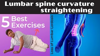 5 Best Loss of Lumbar Lordosis Correction Exercises Lumbar spine curvature exercise [upl. by Edahs]