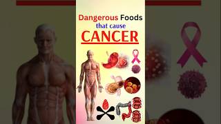 Cancer Causing Foods You Eat EVERY DAY [upl. by Eeleimaj]