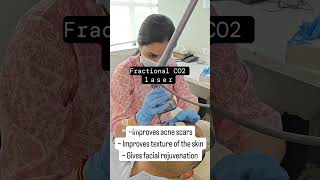 Fractional CO2 Laser Dr Swati Gupta laser acnescars skinrejuvenation openpores dermatologist [upl. by Koo833]