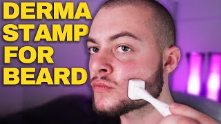 How To Derma Stamp Beard Properly Derma Stamp Tutorial Minoxidil amp Derma Stamp [upl. by Nibla]