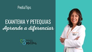 Exantema o Petequias Aprende a diferenciarlas [upl. by Donica]