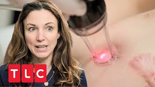 Laserbehandlung für Kind  Dr Emma Hautärztin aus Leidenschaft  TLC Deutschland [upl. by Vladimir423]