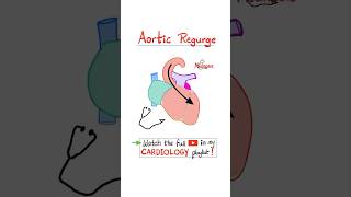 Aortic Regurgitation AR  Valvular Heart Disease VHD…biology science cardiology anatomy [upl. by Larual]