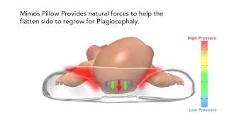 The Clinically Proven Effective Baby Pillow for Plagiocephaly Prevention and Treatment [upl. by Oremo]