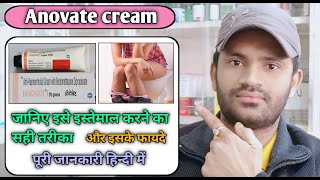 Anovate cream use benefits and Side effects full review in hindiएनोवेट क्रीम [upl. by Nancey94]