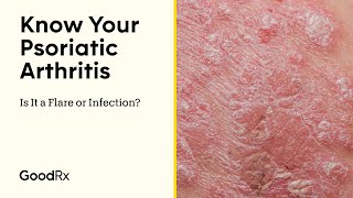 Know Your Psoriatic Arthritis Is It a Flare or Infection  GoodRx [upl. by Ailima]