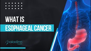 What is Esophageal Cancer  Dr Amit Mathur [upl. by Neelyak]