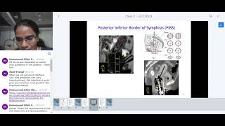 Brachytherapy treatment planning  SCMPCR ELP03  Lecture5 [upl. by Wallinga887]