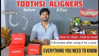 Toothsi Aligners Review And Unboxing 1 year experience  Everthing you need to know 1 [upl. by Madi]