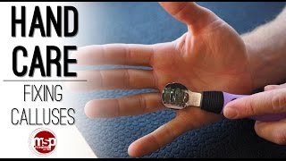 Fixing Calluses  Proper Hand Care for Weight Training  TECHNIQUE HUB [upl. by Isborne]