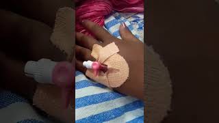 C section video😱 viralvideos vira kgfchapter2 shortsvideo [upl. by Aihsema322]