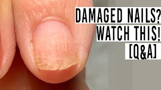 Let’s talk about weakdamaged nails QampA [upl. by Gweneth]