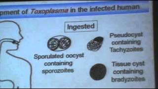 DrAzaa 10  Toxoplasmosis [upl. by Yelahs906]