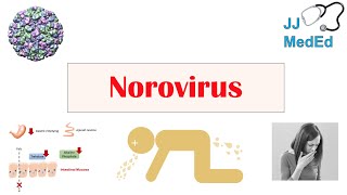 Norovirus Norwalk Virus  Transmission Pathogenesis Symptoms Prevention [upl. by Eeralav]