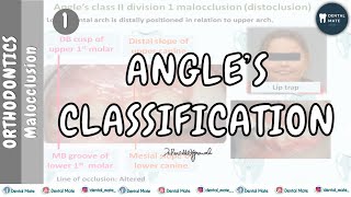 Angles Classification of Malocclusion  Dr Paridhi Agrawal [upl. by Mayyahk31]