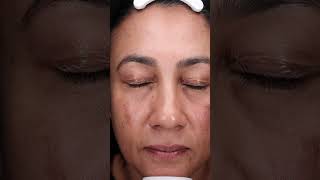 A demonstration of the mesoestetic® mesopeel® melanostop tran3x with Luxe Skin Aesthetics UnboxMe [upl. by Llenreb97]