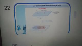 Lelectrosynérèseimmunoélèctrodiffusiontechnique de précipitation🌷Immunologie 3ème année med💊 [upl. by Noy]