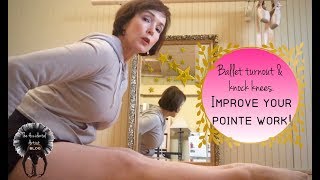 Ballet turnout and knock knees Improve your pointe work Part 2 [upl. by Cloots897]