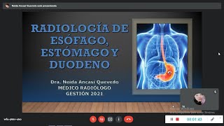 RADIOLOGIA DE ESOFAGO ESTOMAGO Y DUODENO [upl. by Daughtry]