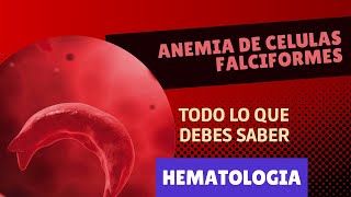 ANEMIA de Células Falciformes ¡Lo que debes saber  Hematología clínica [upl. by Retluoc]