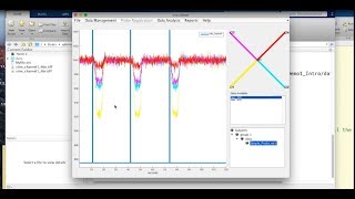 Advanced NIRS Analysis Course 2018  Toolbox GUIs [upl. by Laryssa776]