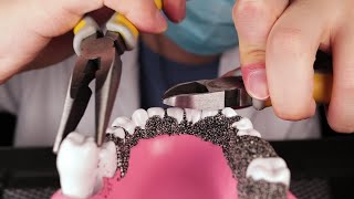 ASMR🦷 Dentist Pulls Your Bad Teeth [upl. by Chere406]