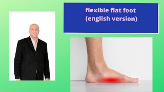 flexible flat foot english version [upl. by Yerkovich77]