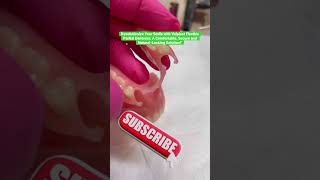 Revolutionize Your Smile with Valplast Flexible Partial Dentures shortvideo foryou dentures [upl. by Airad108]