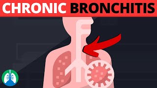 Chronic Bronchitis Medical Definition Quick Explainer Video [upl. by Orna]