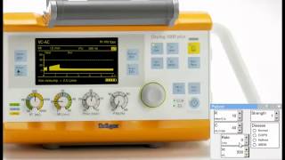 Using the Oxylog 3000 simulator to show patient ventilator asynchrony [upl. by Ransome]