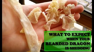 What to Expect When Your Bearded Dragon is Shedding [upl. by Nniuq]