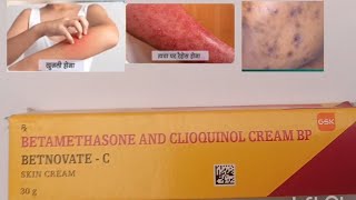 Betnovate C Cream Use Betnovate c cream review Composition Price and Side Effects in Hindi [upl. by Venditti]