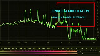 Acoustic Tinnitus Treatment  Binaural Modulation Sounds for Tinnitus Relief [upl. by Busch24]