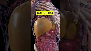 7 Foods To Avoid To Treat Fatty Liver  Fatty Liver  Liver Health shorts [upl. by Volnak]