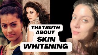 Bollywood Actress Skin Whitening Treatment I Whitening Injection I Whitening Treatment for Skin [upl. by Ellehcem]