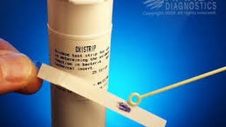 Microbiology oxidase test [upl. by Georas572]