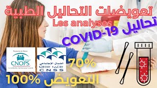 ✅ CNOPS CNSS تعويضات التحاليل الطبية [upl. by Gnel]